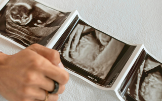 Understanding morning sickness: when it starts, what to expect, and how to deal with it