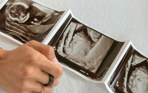 Understanding morning sickness: when it starts, what to expect, and how to deal with it